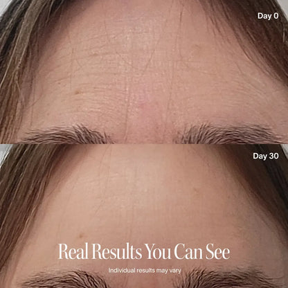 Wrinkle Retreat Pro LED Face Mask