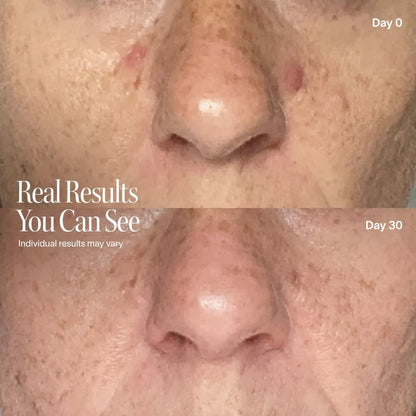 Wrinkle Retreat Pro LED Face Mask